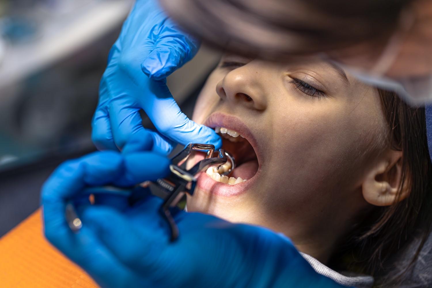 Oral Cancer Screening in United States
