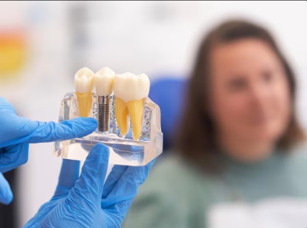 Dental Implants in Tewksbury