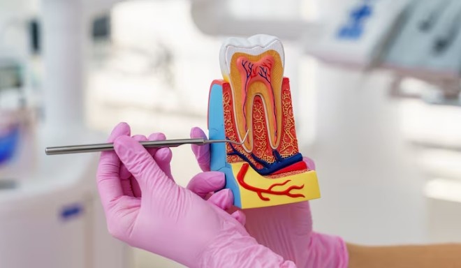 Root Canal Treatment in Tewksbury