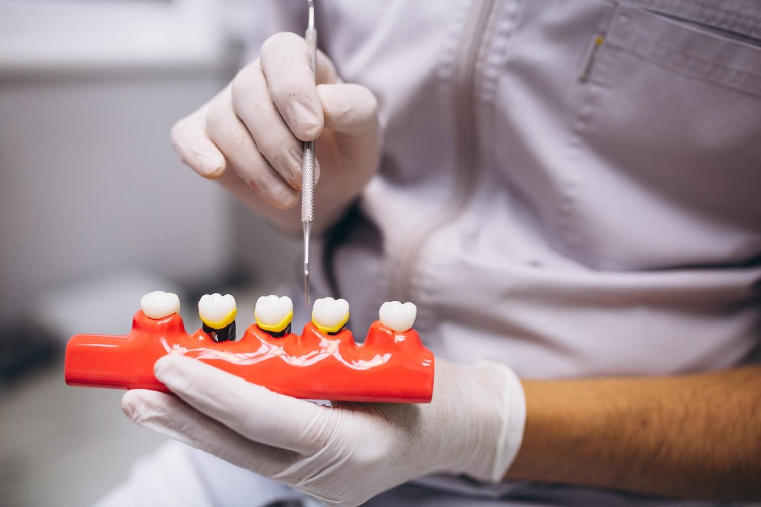 Best Dental Implants in Tewksbury